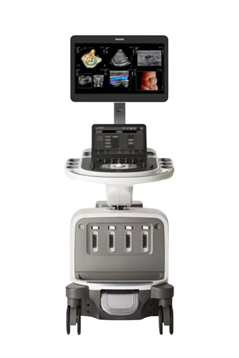 Philips EPIQ Elite  (프리미엄 초음파 시스템)